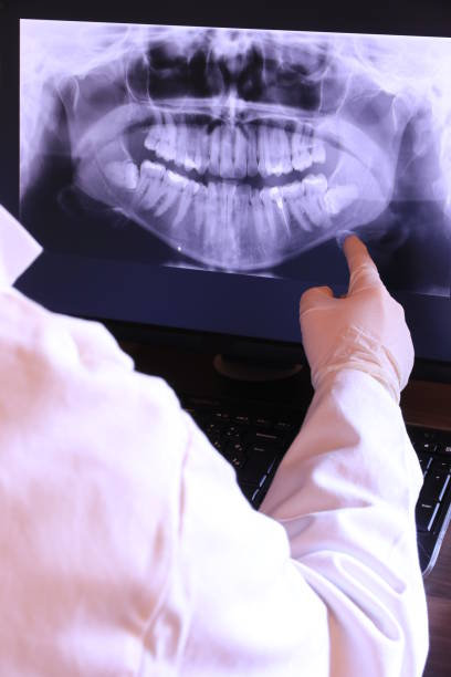 Best Dentist for Tooth Abscess  in Howland Center, OH